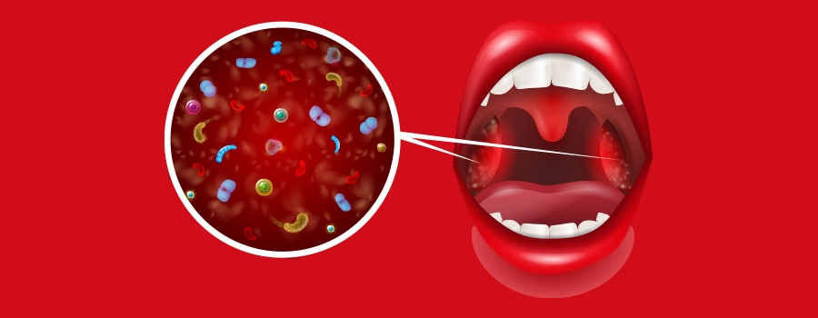 Bacteria-body.webp