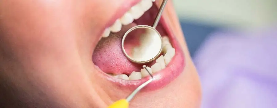 Can-Dental-Implants-Be-Done-on-the-Same-Day.webp