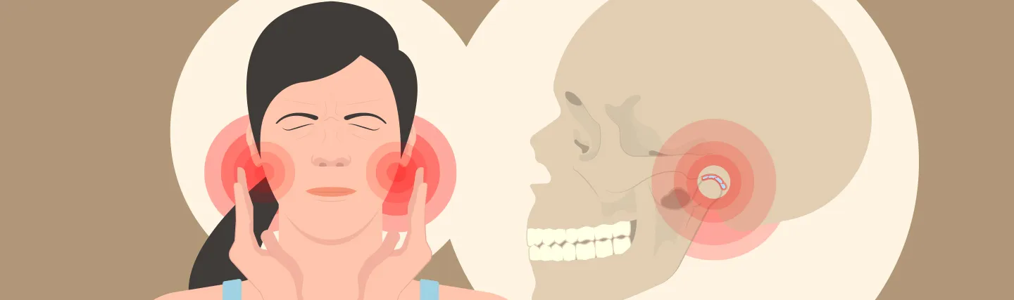 TMJ-disorder-caused-by-bruxism.webp