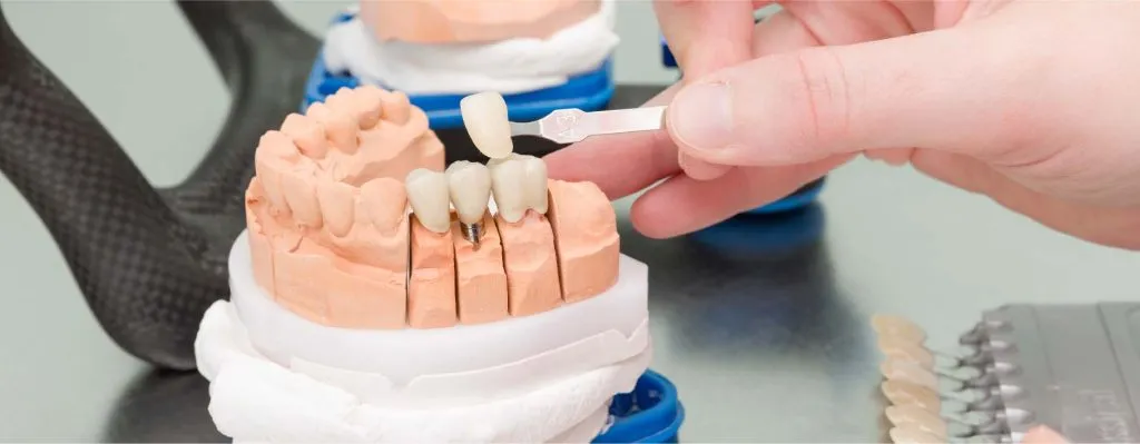What-are-dental-crowns-1024x399.webp