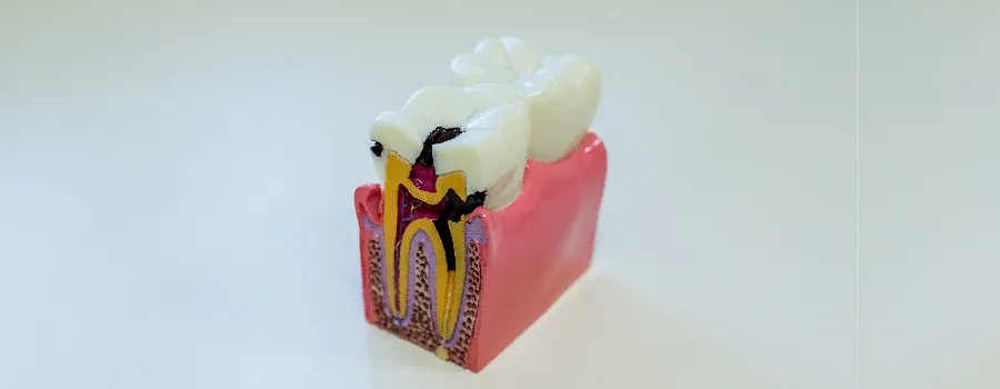 dental-crown-can-cause-nerve-damage.webp