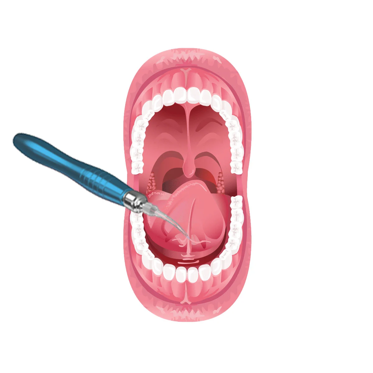 frenectomy-1.webp
