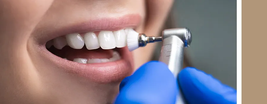 visit-your-dentist-to-remove-tartar-from-your-teeth.webp